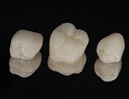 three dental crowns in Ann Arbor against black background 