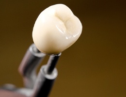 Customized dental crown from digital impression. 