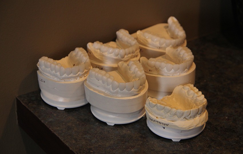 Dental wax-up molds displayed in exam room