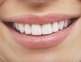 Closeup of flawless smile after dental bonding cosmetic dentistry