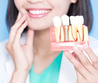 dentist holding a model of dental implants in Ann Arbor