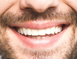 man with attractive smile after diode laser dentistry