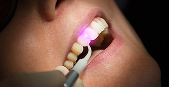 Closeup of patient receiving laser dentistry services