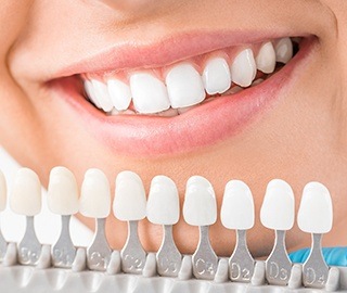 Teeth Color Chart